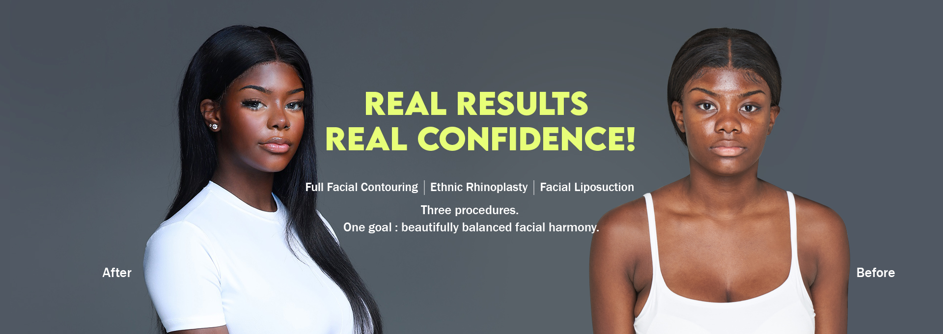 /data/apms/background/BRAUN before and after facial contouring results showing improved facial balance.jpg